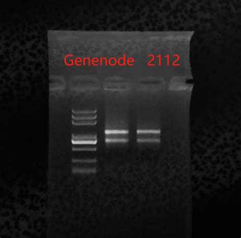 Paxgene Blood Rna Kit Rna Genenode