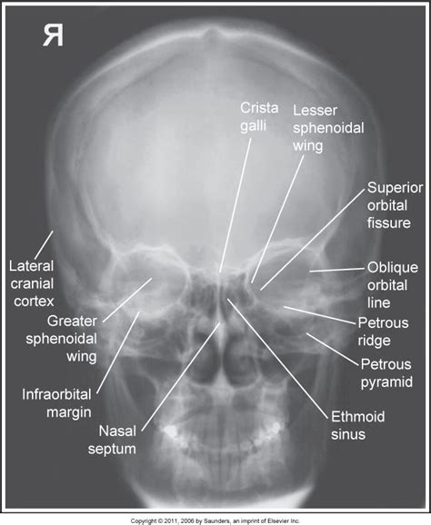Skull Radiography Quizizz