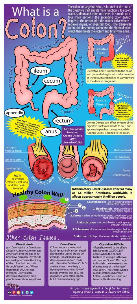 It may also be called colorectal cancer when there is rectal cancer along with colon cancer. When I was first diagnosed with Ulcerative Colitis, I'll ...