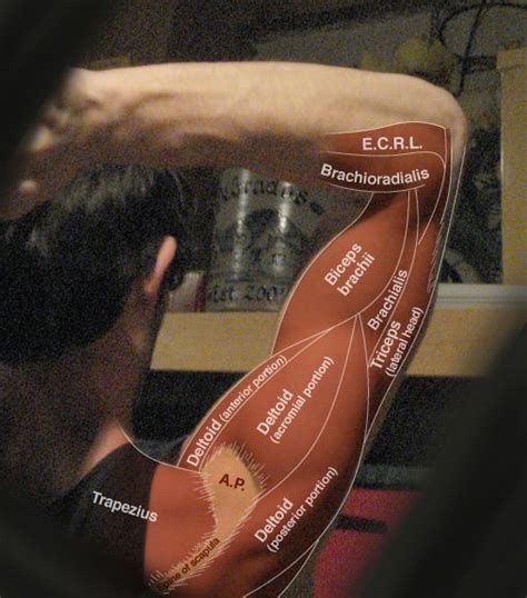 Muscles Of The Upper Arm Repinned By Sos Inc Resources