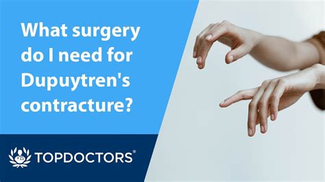 What Surgical Treatment Options Are There For Dupuytrens Contracture