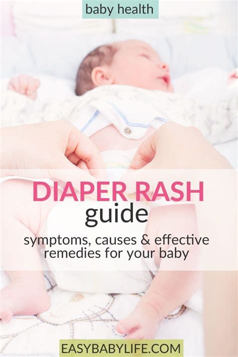 Baby Diaper Rash Guide Symptoms Causes And Effective Remedies Baby