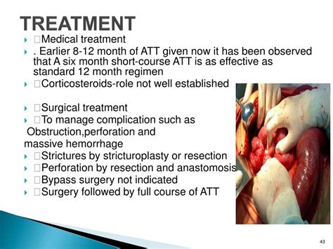 Ppt Abdominal Tuberculosis Powerpoint Presentation Free Download