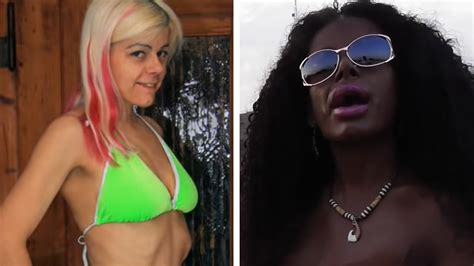 German Model Who Took Melanin Injections To Become Black Talks Racism