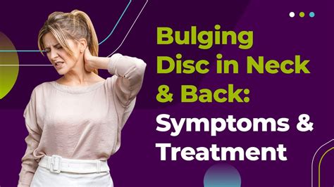 Bulging Disc In Neck And Back Symptoms And Treatment Youtube