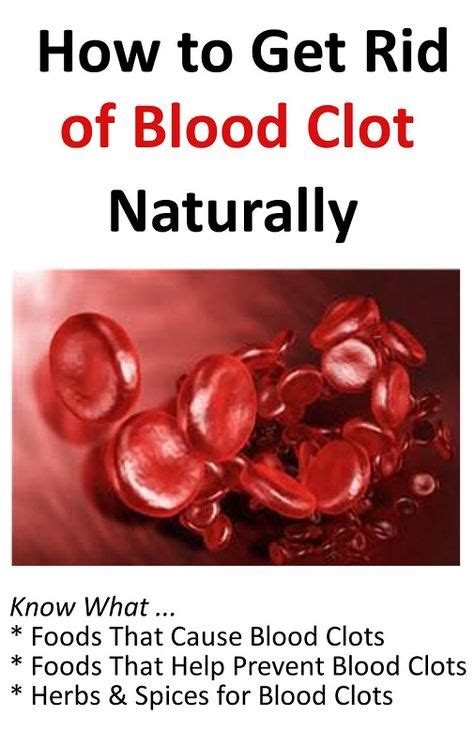 Learning How To Get Rid Of Blood Clot Naturally With Foods Herbs And