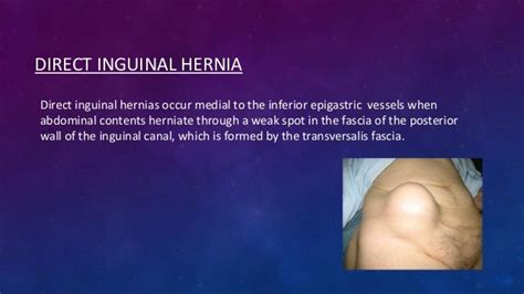 Inguinal Groin Hernia