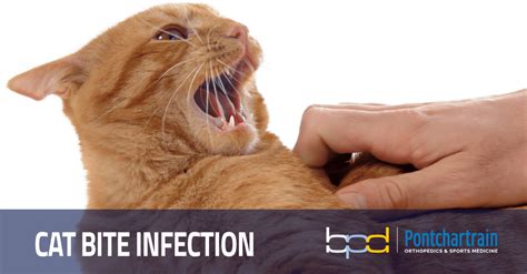 Cat Bite Infection Risk Of Cat Bite To The Hand Brandon P Donnelly Md