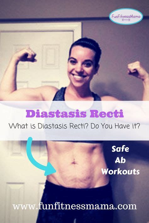 Diastasis Recti What Is It And Do You Have It Diastasis Recti