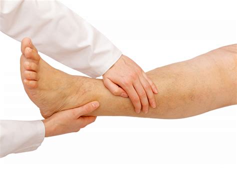 Tennessee Chiropractic Association Chiropractic And Leg Swelling