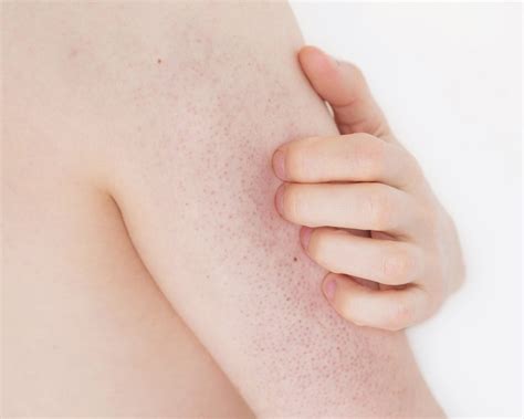 Skin Rash 7 Causes Of Red Spots And Bumps With Pictures