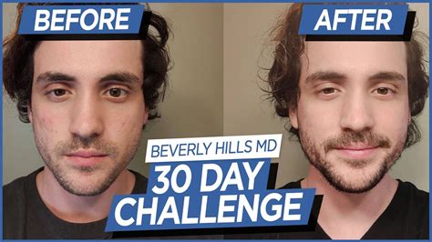 30 Day Skin Care Challenge For Men Beforeafter Youtube