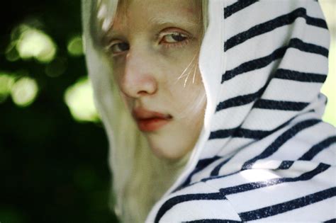 Nastya Kiki Zhidkova Albino Model Albino Melanism