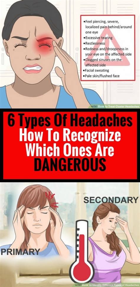 6 Headaches Types How To Detect Those Who Are Dangerous In 2020
