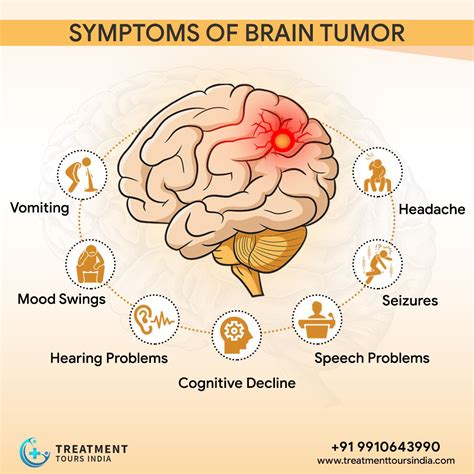 Symptoms Of Brain Tumour At Back Of Head At Symptom