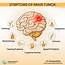 Symptoms Of Brain Tumor  Best Hospitals
