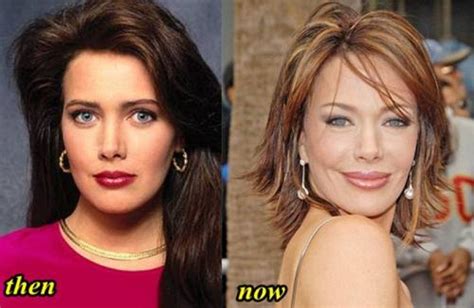 Plastic Surgery Gone Wrong Before And After Hunter Tylo Plastic Surgery