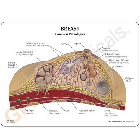 GPI 3450 Breast Cross Section Model