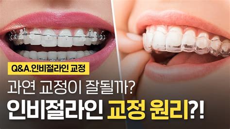 인비절라인 투명교정의 원리는 과연 치아교정이 잘될까 ⏰1분 치아상식 Youtube