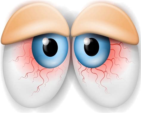 Very Tired Eyes Clipart 20 Free Cliparts Download Images On