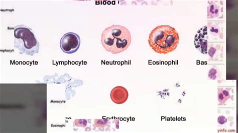 Haematology White Blood Cells And Blast Cells Of Lymphocytes Youtube