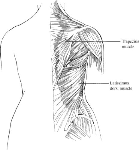Latissimus Dorsi Musculocutaneous Flap Breast Reconstruction Plastic