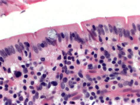 Tecido Epitelial Tecidos Do Corpo Humano Tecido Epitelial Histologia Porn Sex Picture