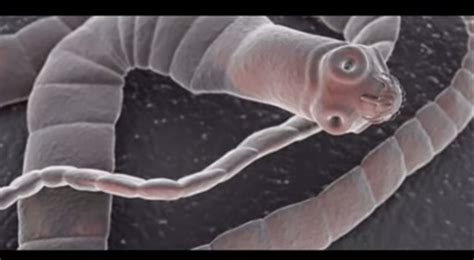 Tapeworms Found Crawling Inside Man S Body After Eating Contaminated Sushi [video] Ibtimes India