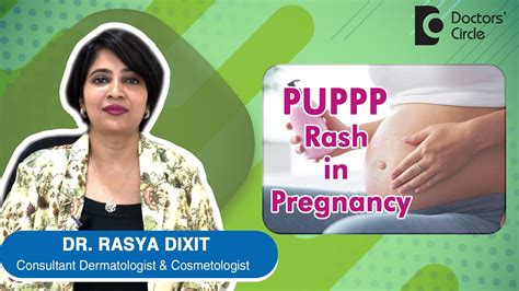 Puppp Rash In Pregnancy Causes Symptoms Prevention And Treatment Dr