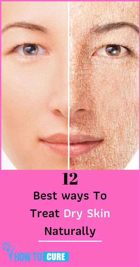 How To Get Rid Of Dry Skin On Face Howtocure Dry Skin On Face