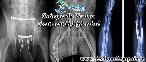 Orthopaedic Trauma Treatment In Hyderabad Orthopedic Trauma