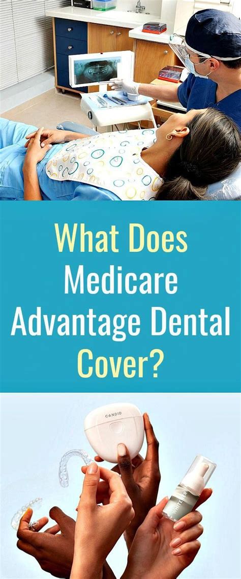 Apply for dental coverage within minutes. What Does Medicare Advantage Dental Cover? in 2020 | Dental cover, Dental insurance plans ...