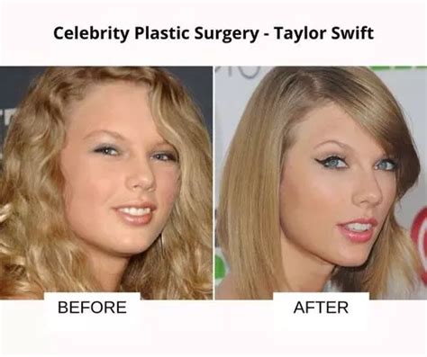 Taylor Swift Plastic Surgery Butt