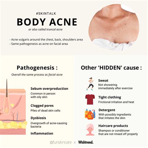 Skincare Tips For Body Acne From Cleansing To Non Skincare Tips