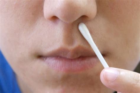 How To Get Rid Of Cold Sores Under The Nose