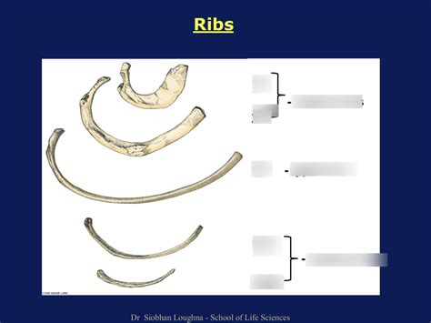 Types Of Ribs And Their Respective Examples Diagram Quizlet