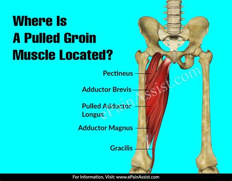 Where Is A Pulled Groin Muscle Locatedbest Yoga Poses For Pulled Groin