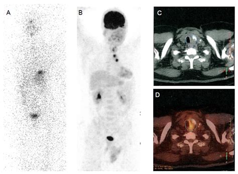Cancers Free Full Text Advances In Functional Imaging Of