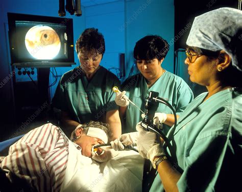 Endoscope Examination And Biopsy Of The Stomach Stock Image M4400145