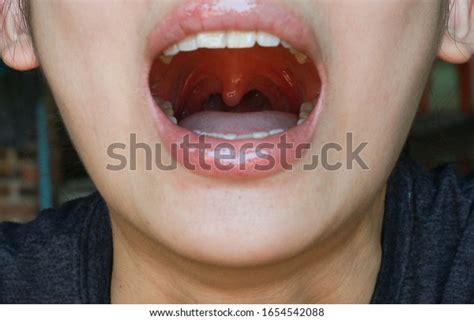 Open Wide Mouth Swollow Uvula Showing Stock Photo Edit Now 1654542088