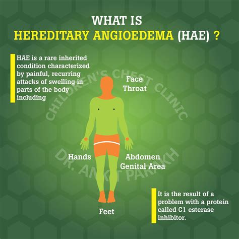 Hereditary Angioedema Causes Symptoms And Treatment Dr Ankit Parakh