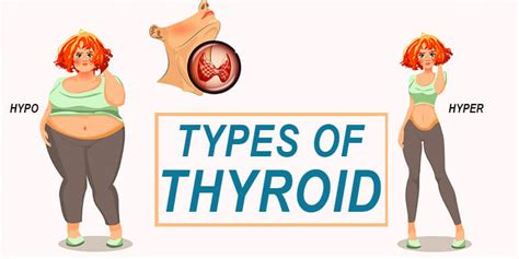 Hyper Vs Hypo Thyroidism Slideshare