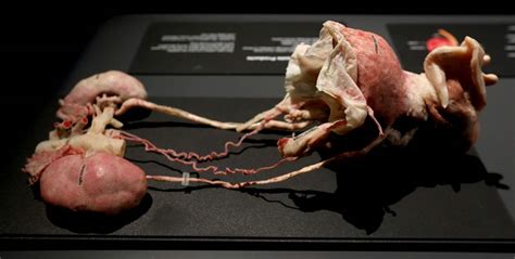 What Lies Beneath Exhibit Gives Realistic Look At Human Body The Blade