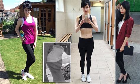 Anorexic Woman Said Facebook And Instagram Fuelled My Anorexia