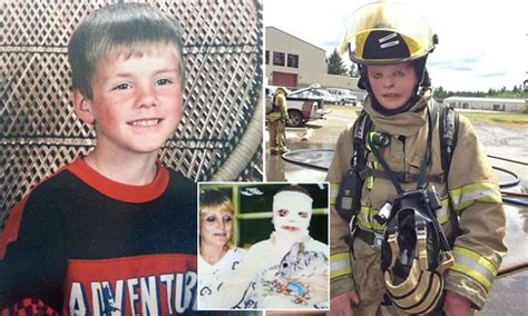 B The Courageous Burns Victim Who Became A Firefighter
