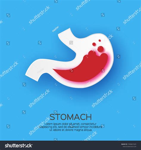 Stomach Acid Reflux Gastric Acid Paper Stock Vector Royalty Free