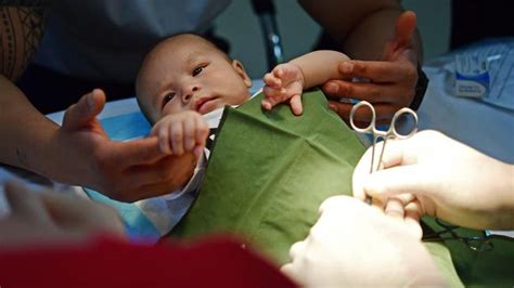 Circumcision Should I Circumcise My Baby Son Herald Sun