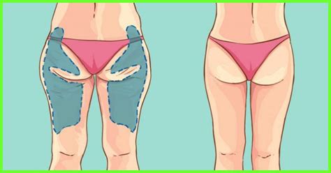 Weight gain on the legs can also cause chafing that can be uncomfortable. 12 Ways To Lose Excess Hip Fat Naturally At Home