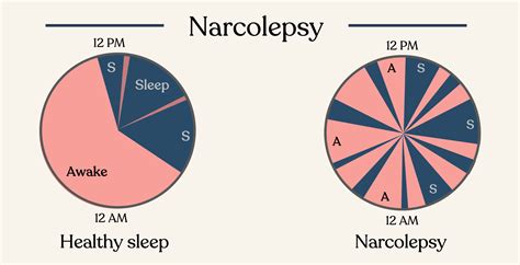 Narcolepsy Pictures