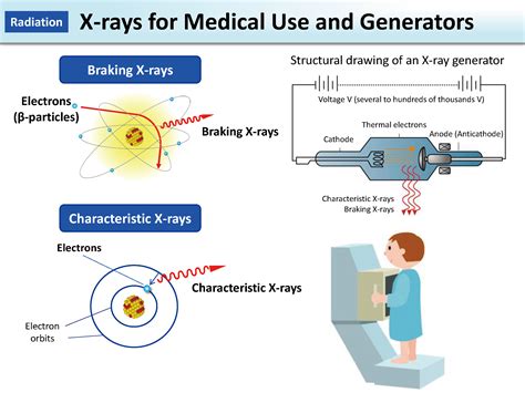 X Rays For Medical Use And Generators Moe